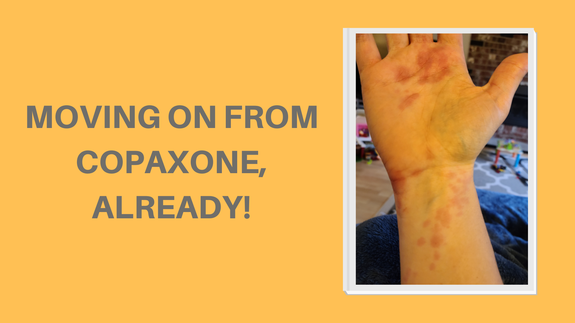 Moving on from Copaxone, Already!