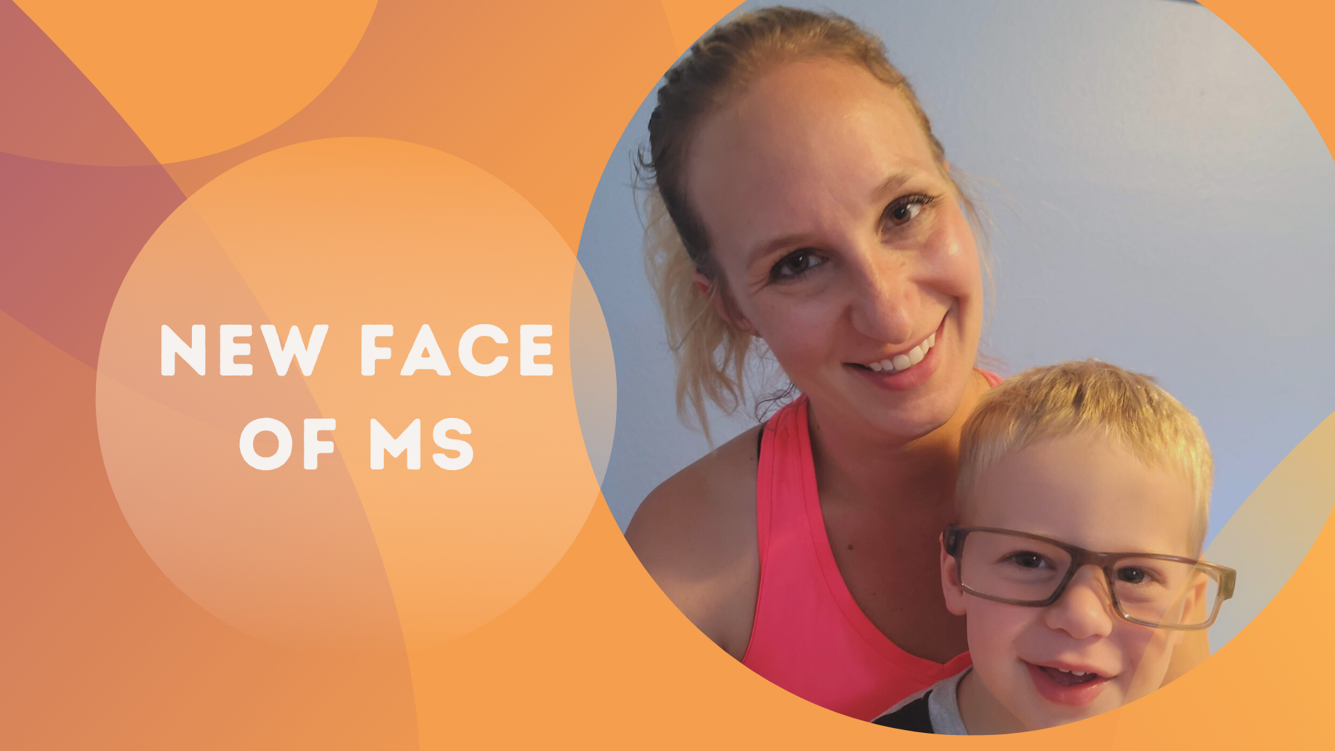 New Face of MS